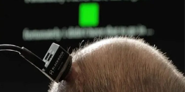 فرصتی برای یک مکالمه لحظه ای برای یک مرد فلج با فناوری جدید فراهم کنید